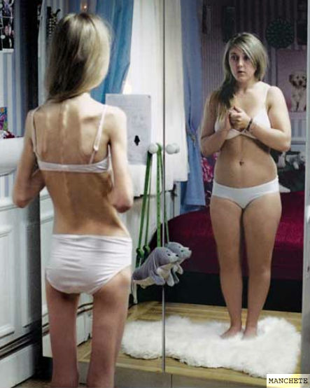 Foto de Acolhimento e dieta