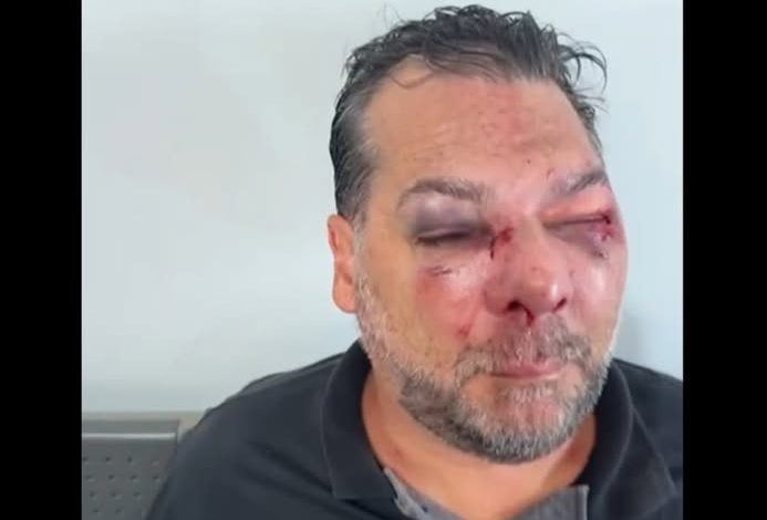 Lutador de Muay Thai é preso após espancar brutalmente um colega de trabalho 1 agressao Lutador de Muay Thai é preso após espancar brutalmente um colega de trabalho