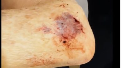 Foto de Denúncia de mau atendimento de hospital de Maringá aos servidores públicos